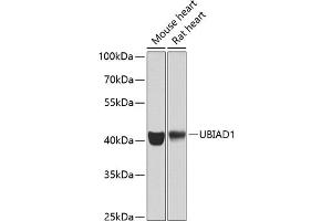 Western blot analysis of extracts of various cell lines, using UBI antibody (ABIN6134946, ABIN6149845, ABIN6149848 and ABIN6223555) at 1:1000 dilution. (UBIAD1 antibody  (AA 1-100))