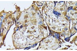 Immunohistochemistry of paraffin-embedded Human placenta using DAPK3 Polyclonal Antibody at dilution of 1:100 (40x lens).