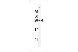 FAT10 Antibody (C-term) (ABIN655263 and ABIN2837857) western blot analysis in mouse liver tissue lysates (35 μg/lane). (UBD antibody  (C-Term))
