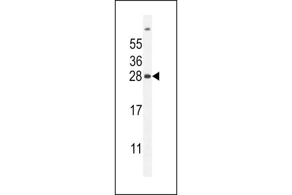 UBD Antikörper  (C-Term)