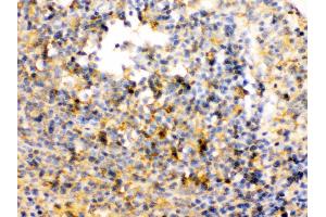 TRIB2 was detected in paraffin-embedded sections of rat spleen tissues using rabbit anti- TRIB2 Antigen Affinity purified polyclonal antibody at 1 μg/mL. (TRIB2 antibody  (Middle Region))