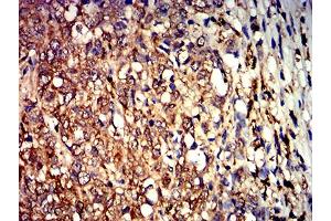 Immunohistochemistry (IHC) image for anti-Aldolase A, Fructose-Bisphosphate (ALDOA) (AA 9-145) antibody (ABIN5611221)