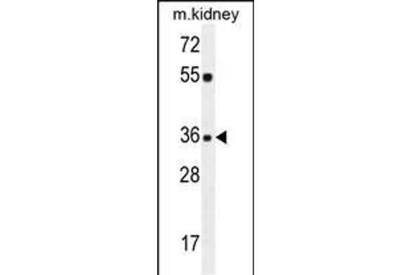 KLF14 anticorps  (C-Term)