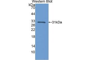 Detection of Recombinant CALB, Rat using Polyclonal Antibody to Calbindin (CALB) (CALB1 antibody  (AA 2-261))