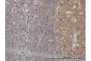 Image no. 1 for anti-RAB21, Member RAS Oncogene Family (RAB21) (AA 116-226) antibody (ABIN599189) (RAB21 antibody  (AA 116-226))