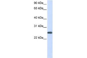 PRDX1 antibody used at 1 ug/ml to detect target protein. (Peroxiredoxin 1 antibody  (N-Term))