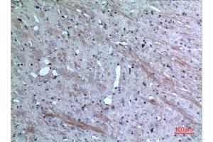 Immunohistochemistry (IHC) analysis of paraffin-embedded Rat Brain, antibody was diluted at 1:100. (CCL26 antibody  (Internal Region))