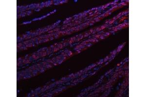 IF analysis of hnRNP L/HNRNPL using anti-hnRNP L/HNRNPL antibody (ABIN7600130). (HNRNPL antibody  (AA 152-569))