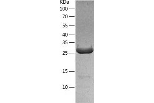 IMPA1 Protein (AA 1-277) (His tag)