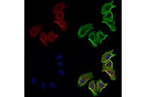 ABIN7094848 and ABIN7098899 staining Hela cells by IF/ICC.