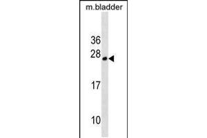 Western blot analysis in mouse bladder tissue lysates (35ug/lane). (TPD52L1 antibody  (N-Term))