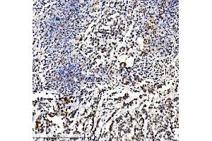 IHC analysis of VPRBP/DCAF1 using anti-VPRBP/DCAF1 antibody (ABIN7599063). (DDB1 and CUL4-Associated Factor 1 (DCAF1) (AA 1-195) antibody)