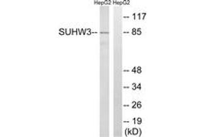 Western blot analysis of extracts from HepG2 cells, using ZNF280C Antibody. (ZNF280C antibody  (AA 251-300))