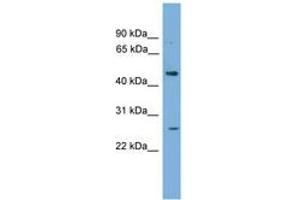 Image no. 1 for anti-H2.0-Like Homeobox (HLX) (AA 323-372) antibody (ABIN6745227) (HLX antibody  (AA 323-372))