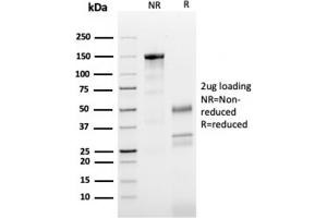 SDS-PAGE Analysis Purified Tubulin beta 3 Mouse Monoclonal Antibody (TUBB3/3731). (TUBB3 antibody  (AA 437-450))