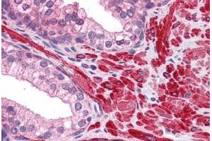 Human Prostate: Formalin-Fixed, Paraffin-Embedded (FFPE) (DPP8 antibody  (AA 1-39))