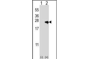 Western blot analysis of NME4 (arrow) using rabbit polyclonal NME4 Antibody (M1) (ABIN392784 and ABIN2842222). (NME4 antibody  (N-Term))