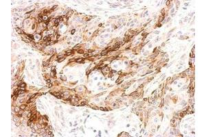 IHC-P Image Galanin Receptor 2 antibody detects GALR2 protein at membrane on Cal27 xenograft by immunohistochemical analysis. (GALR2 antibody  (C-Term))