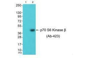 Western blot analysis of extracts from 3T3 cells (Lane 2), using p70 S6 Kinase β (Ab-423) antiobdy.