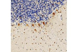 IHC analysis of RPS17 using anti-RPS17 antibody (ABIN7598984). (RPS17 antibody  (AA 1-135))