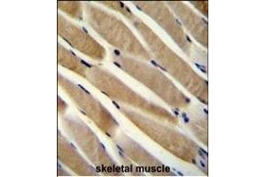 TRIM7 Antibody (N-term) (ABIN655918 and ABIN2845317) immunohistochemistry analysis in formalin fixed and paraffin embedded human skeletal muscle followed by peroxidase conjugation of the secondary antibody and DAB staining.