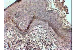 AP31562PU-N (2 µg/ml) staining of paraffin embedded Human Skin. (CMA1 antibody  (Internal Region))