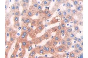 Immunohistochemistry (IHC) image for anti-Cytochrome P450, Family 2, Subfamily E, Polypeptide 1 (CYP2E1) (AA 126-309) antibody (ABIN1174041)