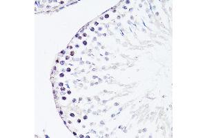 Immunohistochemistry of paraffin-embedded rat testis using FGF12 antibody (ABIN3016419, ABIN3016420, ABIN1679841 and ABIN6219744) at dilution of 1:150 (40x lens). (FGF12 antibody  (AA 1-181))