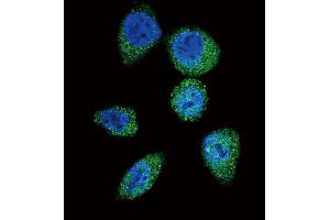 Confocal immunofluorescent analysis of mTOR (FR) Antibody  (ABIN390217 and ABIN2840698) with Hela cell followed by Alexa Fluor 488-conjugated goat anti-rabbit lgG (green). (MTOR antibody  (AA 2459-2488))