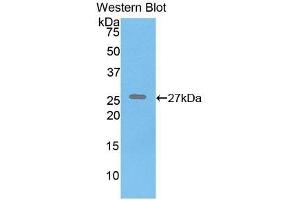 Detection of Recombinant ELN, Human using Polyclonal Antibody to Elastin (ELN) (Elastin antibody  (AA 392-645))