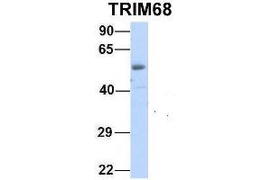 Host:  Rabbit  Target Name:  TRIM68  Sample Type:  Human Fetal Heart  Antibody Dilution:  1.