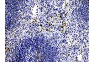 IHC analysis of Caspase8 using anti-Caspase8 antibody . (Caspase 8 antibody  (N-Term))