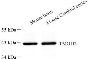 Western blot analysis of TMOD2 (ABIN7076027) at dilution of 1: 500