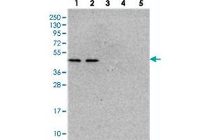 Western blot analysis of Lane 1: RT-4, Lane 2: U-251 MG, Lane 3: Human Plasma, Lane 4: Liver, Lane 5: Tonsil with NSUN6 polyclonal antibody  at 1:250-1:500 dilution. (NSUN6 antibody)