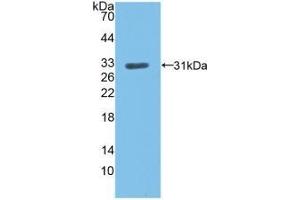 Detection of Recombinant LDLR, Human using Polyclonal Antibody to Low Density Lipoprotein Receptor (LDLR) (LDLR antibody  (AA 497-742))