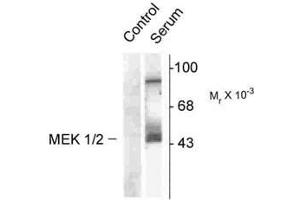 Image no. 1 for anti-Mitogen-Activated Protein Kinase Kinase 1 (MAP2K1) (pSer218), (Ser222) antibody (ABIN221121) (MEK1 antibody  (pSer218, Ser222))