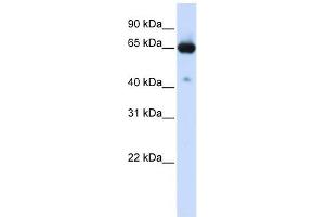 SLC39A4 antibody used at 1 ug/ml to detect target protein. (SLC39A4 antibody)