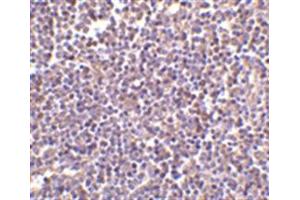 Image no. 2 for anti-CD5 Molecule-Like (CD5L) (N-Term) antibody (ABIN318737) (CD5L antibody  (N-Term))