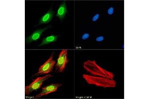 Immunofluorescence staining of fixed HeLa cells with anti-H3K27me3 antibody BT164. (Recombinant Histone 3 antibody  (H3K27me3))