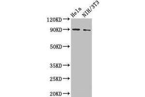 Western Blot Positive WB detected in: Hela whole cell lysate, NIH/3T3 whole cell lysate All lanes: L1CAM antibody at 2 μg/mL Secondary Goat polyclonal to rabbit IgG at 1/50000 dilution Predicted band size: 141, 140, 139 kDa Observed band size: 90 kDa (L1CAM antibody  (AA 995-1119))