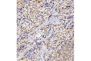 Immunohistochemistry of paraffin embedded rat spleen using GP1BA (ABIN7074109) at dilution of 1:500 (300x lens) (CD42b antibody)
