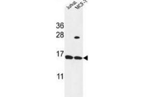 Western blot analysis in Jurkat,MCF-7 cell line lysates (35ug/lane) using SPRR1A / Cornifin-A Antibody (C-term).