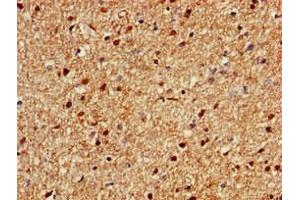 Immunohistochemistry of paraffin-embedded human brain tissue using ABIN7166170 at dilution of 1:100 (Chromosome 1 Open Reading Frame 84 (C1orf84) (AA 2396-2517) antibody)