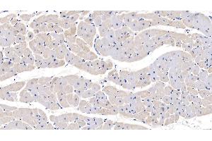 Detection of PTP4A3 in Human Cardiac Muscle Tissue using Polyclonal Antibody to Protein Tyrosine Phosphatase Type IVA 3 (PTP4A3) (PTP4A3 antibody  (AA 1-170))