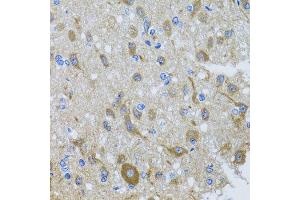 Immunohistochemistry of paraffin-embedded rat brain using DYNC1I1 antibody at dilution of 1:100 (x40 lens). (DYNC1I1 antibody)