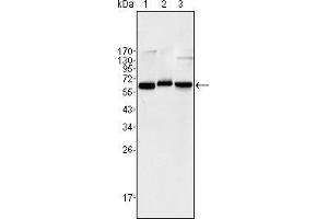 Western blot analysis using NF-κB p65 mouse mAb against Jurkat (1), K562 (2) and NIH/3T3 (3) cell lysate. (NF-kB p65 antibody)