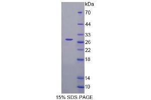 SDS-PAGE (SDS) image for Fas-Activated serine/threonine Kinase (FASTK) (AA 330-511) protein (His tag) (ABIN4989280)