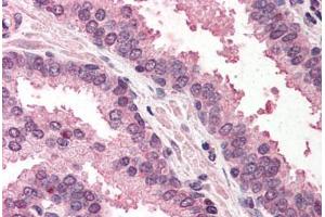 Human Prostate (formalin-fixed, paraffin-embedded) stained with RAD23A antibody ABIN290446 at 5 ug/ml followed by biotinylated anti-goat IgG secondary antibody ABIN481715, alkaline phosphatase-streptavidin and chromogen. (RAD23A antibody  (AA 122-135))