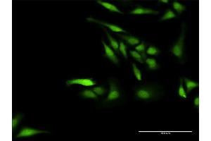 Immunofluorescence of purified MaxPab antibody to NPLOC4 on HeLa cell. (NPLOC4 antibody  (AA 1-608))