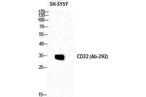 Western Blotting (WB) image for anti-Fc gamma RII (CD32) (Ser376) antibody (ABIN3179925) (Fc gamma RII (CD32) (Ser376) antibody)